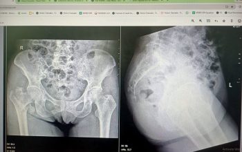 Diduga Lalai dan Asal Periksa, Pelayanan RSUD Kota Tanjungpinang Dikeluhkan Keluarga Pasien